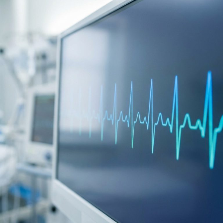 ECG trace on a monitor
